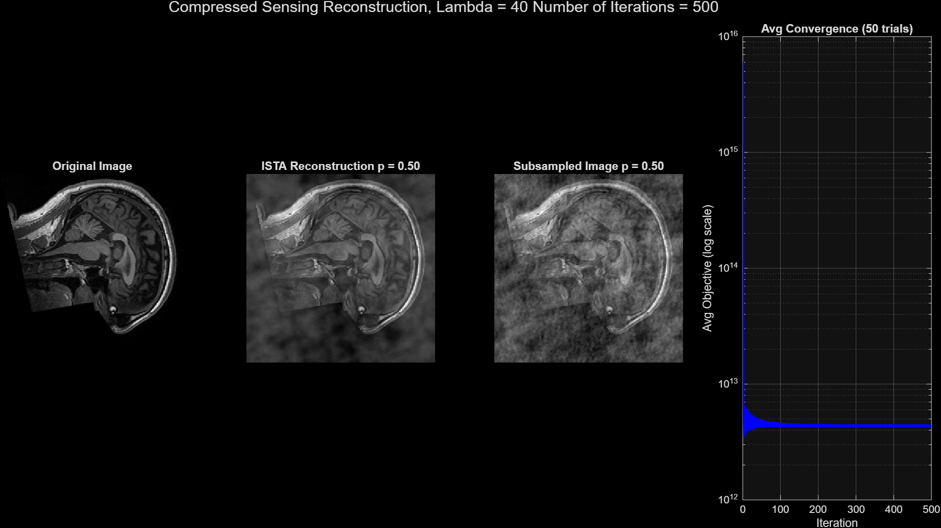 MRI Reconstruction